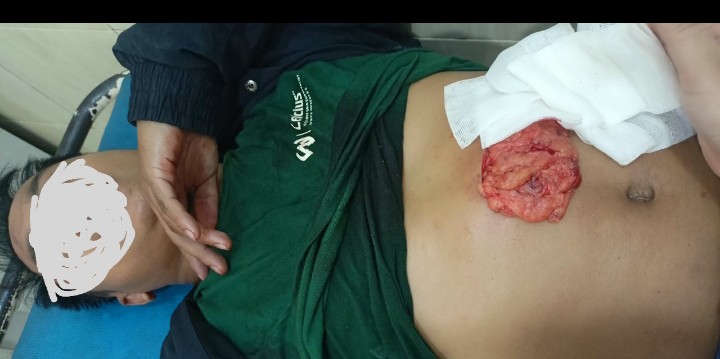 Cekcok di Pantai Seta-Seta Berujung Maut, Satu Orang Tewas Ditikam di Desa Poreang